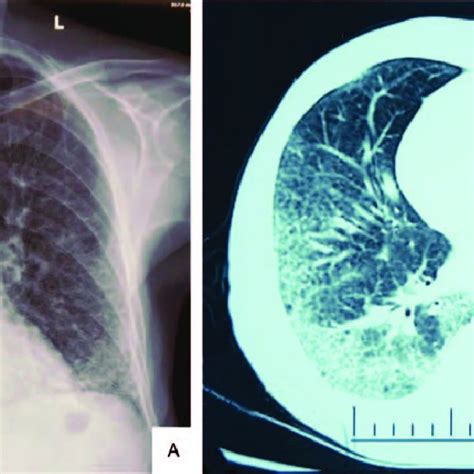 rayas imaging